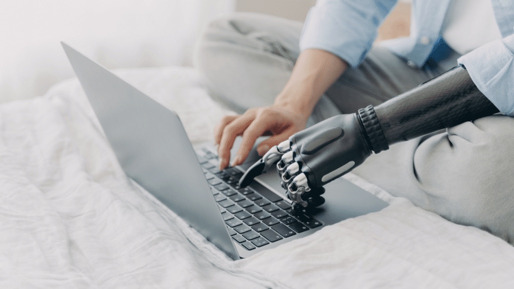 persona con prótesis en el brazo, escribiendo en el ordenador