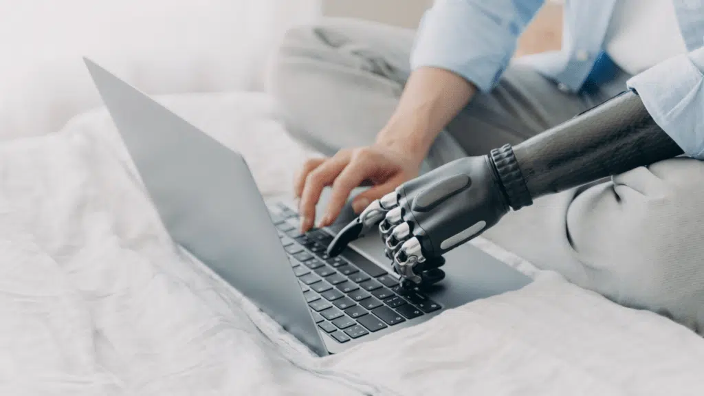 persona con prótesis en el brazo, escribiendo en el ordenador